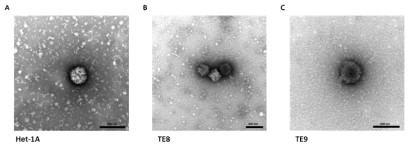 식도 상피세포 (Het-1A)와 식도암 세포 (TE8, TE9) 엑소좀 모양 확인