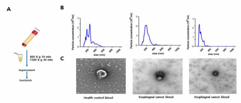 정상대조군혈액과 식도암 환자 혈액의 엑소좀 특징