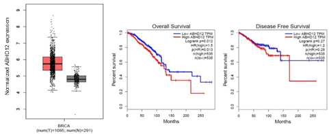 ABHD12 transcript 과발현을 TCGA데이터에서 분석함.