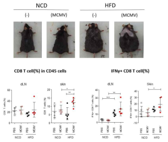 MCMV 잠복감염 마우스에서 고지방식이에 의한 피부질환 발병 및 IFNγ+ CD8 T세포 증가