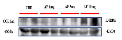 COL1A1 단백질 정량