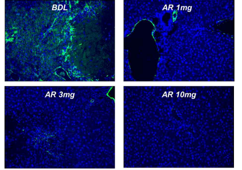 Bile duct ligation model에서 간 내 섬유화 마커인 α-SMA 감소