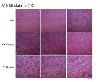 간의 H&E 염색 결과