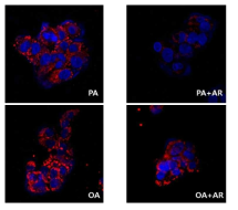 NASH 유도된 HepG2 세포에서 오라노핀 투여로 인한 lipid droplet 변화 확인