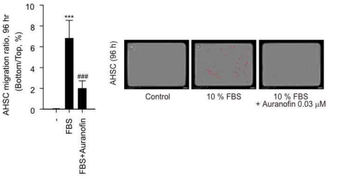 일차배양 간 성상세포에서 진행한 chemotaxis assay