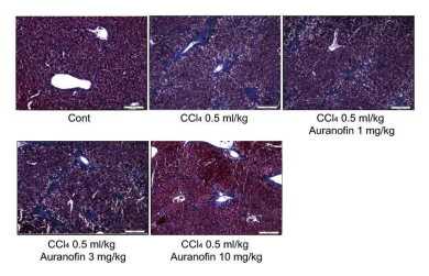 Masson’s Trichrome staining