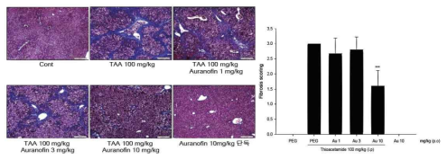 Masson’s Trichrome staining과 fibrosis score