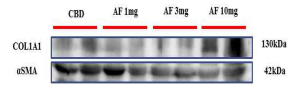 COL1A1 단백질 정량