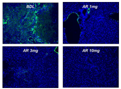 Bile duct ligation model에서 간 내 섬유화 마커인 α-SMA 감소