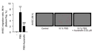 일차배양 간 성상세포에서 진행한 chemotaxis assay