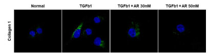 간 성상세포 내 오라노핀 투여로 인한 섬유화 관련 단백질 발현 확인 (IF)