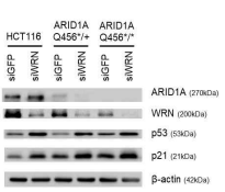 WRN 조절에 의한 세포주기 단백질 발현
