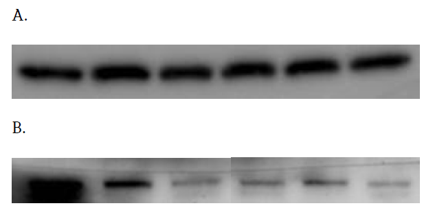 (A) β-Actin, (B) ADGRG4. 왼쪽부터 A375, A375(siRNA 24h), A375(siRNA 48h), H29, H29(siRNA 24h), H29(siRNA 48h), -Actin antibody (santa cruz, S-47778), ADGRG4 antibody (Thermo, PA5-99890)