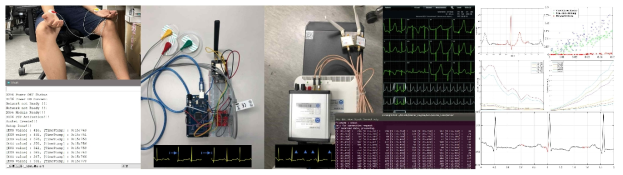 3단계 주요 산출물: NB-IoT / LTE Cat-M1 기반 ECG 텔레메트리 테스트베드 구축 및 동작 특성 평가