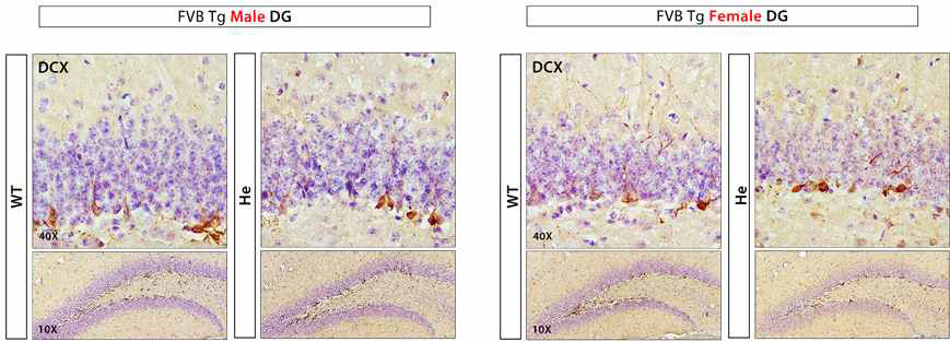 LRRK2G2019S Tg 마우스의 성별에 따른 neurogenesis marker 발현 평가