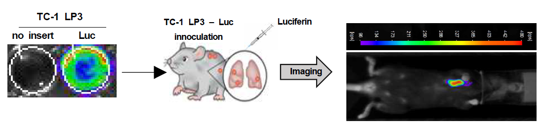 동소이식 폐암모델 시각화 기술 확립