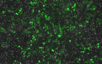 293T cell에 RV-MFG-EGFP-Puro Transfection 2일차 (100x, GFP 2000ms 노출)