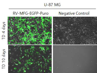 U-87 MG/RV-EGFP Puromycin selection (100x, GFP 2000ms 노출)