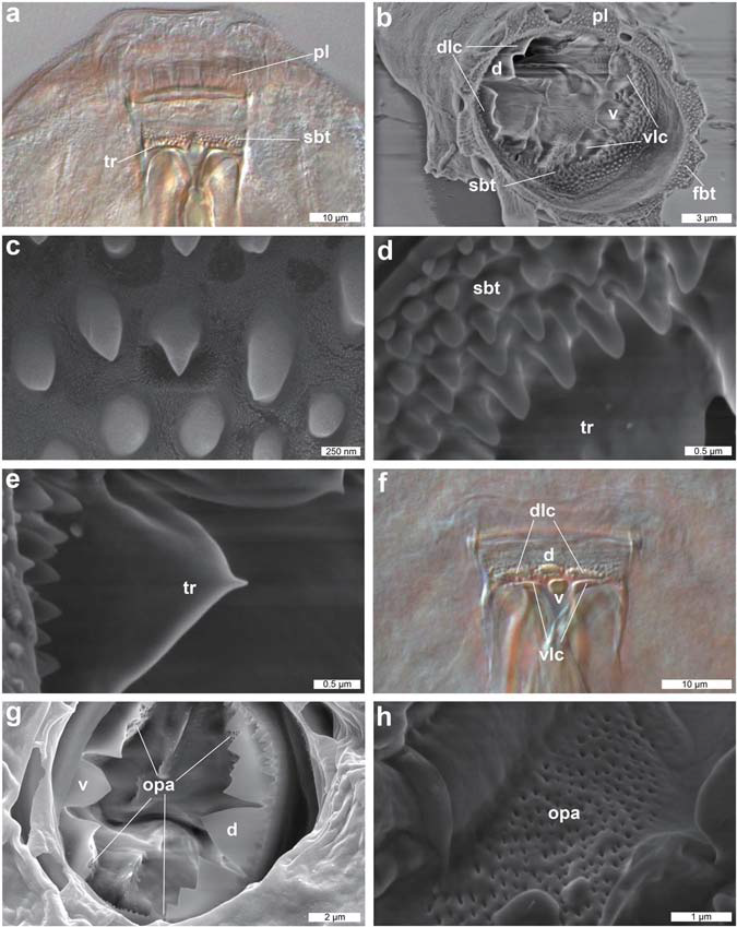 DIC and SEM images of mouth structures of Dactylobiotus ovimutans sp. nov. (a) The anterior part of the buccal-pharyngeal apparatus (DIC). (b) The anterior view of the buccal-pharyngeal apparatus (SEM). (c) the first band of teeth (SEM). (d) The second band of teeth (SEM). (e) the transverse crest (SEM). (f) the transverse crests (DIC). (g) four oval perforated areas and oral cavity armature (SEM). (h) the oval perforated area (SEM). d: dorsomedian transverse crest, dlc: dorsolateral transverse crest, fbt: first band of teeth, opa: oval perforated area, pl: peribuccal lamella, sbt: second band of teeth, tr: transverse crest, v: ventromedian crest, vlc: ventrolateral crest