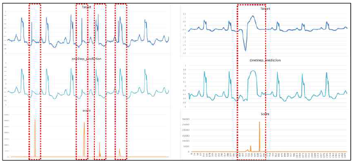 [비정상 신호] 가 포함된 심장박동 시계열 신호의 알고리즘 결과. 비정상 신호구간 (빨간색 대쉬)의 경우, 입/출력 신호간 상당히 다른 파형을 만들어내어, 높은 Score를