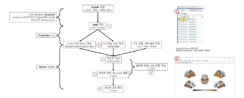 뇌영상표준화 프로세스 및 결과 자료 예시