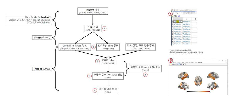 뇌영상표준화 프로세스 및 결과 자료 예시