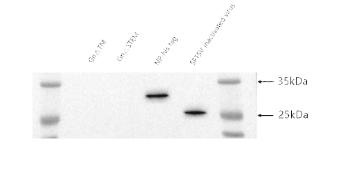 SFTSV-NP antibody의 활성 확인하는 Western-Blot 진행. (SFTSV-NP antibody dilution 1:1000)