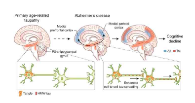 대표적인 알츠하이머 질환을 유발하는 amyloid beta 기전