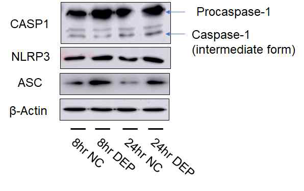 Inflammasome factor expression in A549 cells using western blot.