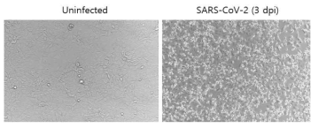 Vero cell에서 SARS-CoV-2 감염에 의한 CPE 확인