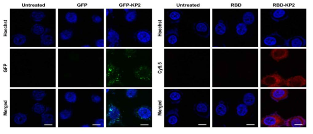 공초점현미경을 이용한 GFP, GFP-KP2, RBD, RBD-KP2의 세포 내 전달율 분석
