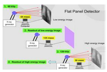 Multi Energy X-ray 기술