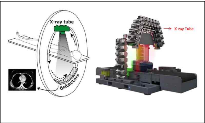 회전형과 고정형 CT 개념도