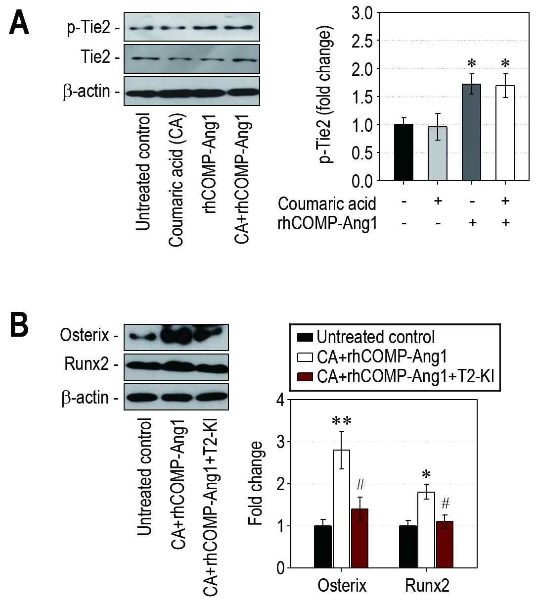 인간 치주인대세포의 골세포 분화유도 인자의 발현에 미치는 coumaric acid와 rhCOMP-Ang1의 효과 및 이에 대한 T2-KI의 효과. A, Western blotting을 활용한 Tie2 인산화에 미치는 효과 확인. B, Coumaric acid 및 rhCOMP-Ang1 유도성 Tie2 인산화의 T2-KI 처리에 따른 억제 효과 확인.