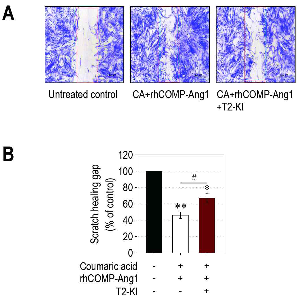 배양된 hPLF에 대한 scratch 생성 및 coumaric acid, rhCOMP-Ang1 또는 병행처리에 따른 세포의 이동 효과 확인. A, 생성된 scratched gap과 물질 처리에 따른 세포의 이동 모습. B, ImageJ software를 활용한 Scratch healing gap(%)의 확인 결과.
