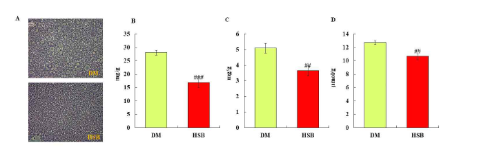 간조직의 H&E 염색(A), 지질함량(B:중성지질, C 콜레스테롤, D: 유리지방산). 200배율 현미경 촬영. 실험결과는 평균±표준오차로 표기하였으며, 대조군과 비교시 ##p ＜0.01, ###p＜0.001로 표기하였음.