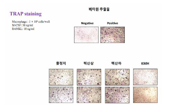 베타원 물추출물의 추출 방법에 따른 파골세포 억제