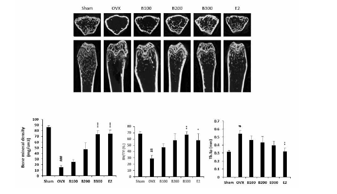 각 대조군 간의 뼈사진 및 골절위험 기전 분석 (#: Sham 대조군과 대조, *: OVX 대조군과 대조)