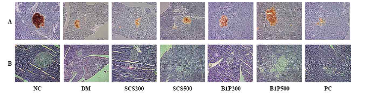 췌장조직의 인슐린(A)과 H&E(B) 염색. 200배율 현미경 촬영.
