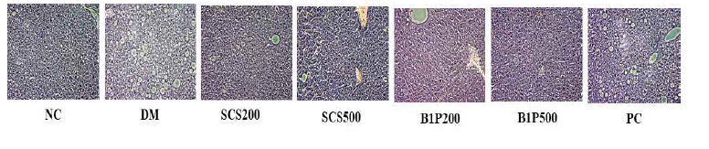 SCS와 B1P의 간조직의 H&E 염색. 200배율 현미경 촬영.