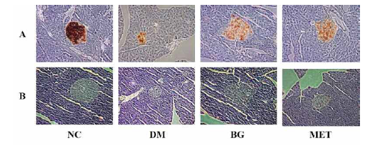 베타글루칸농축물의 췌장 인슐린(A)과 H&E(B). 200배율 현미경 촬영.