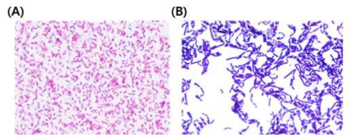 분리된 균주의 그람염색 결과. (A) gram negative, (B) gram positive