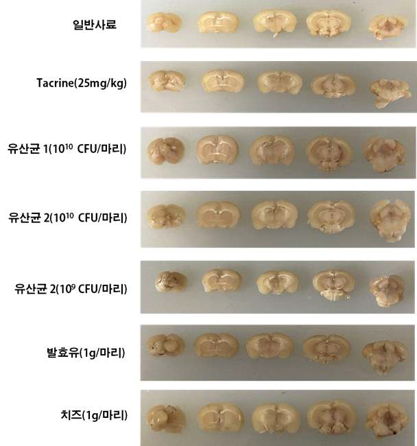 Fixed brain of the Alzheimer model mouse for section