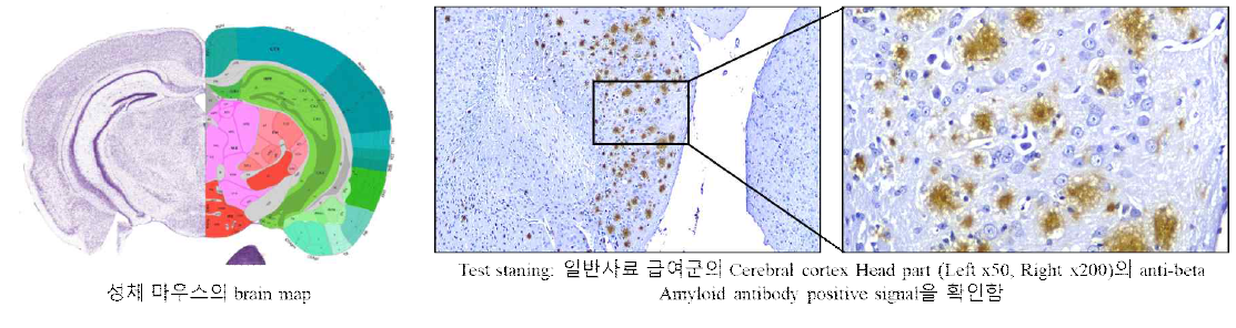 Brain map and β-amyloid plaque enumeration