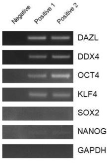 병아리 정소유래 cDNA RT-PCR 결과