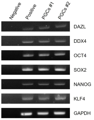 닭 원시생식세포유래 cDNA RT-PCR 결과