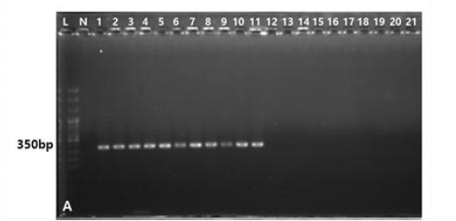 Macrophomina phaseolina 종 특이적 프라이머 MpKFI/MpKRI의 특이성. L; 100 bp plus DNA ladder, N; Negative control, 1; M. phaseolina YSW16-177, 2; M. phaseolina NSW17-108, 3; M. phaseolina HSW18-055, 4; M. phaseolina ASH20-001, 5; M. phaseolina ASH21-025, 6; M. phaseolina 21JD1, 7; M. phaseolina 21DO1, 8; M. phaseolina 21HD1, 9; M. phaseolina 21WM4, 10; M. phaseolina 21RB1, 11; M. phaseolina HCP17-043, 12; Diapo rthe longicolla DI20-001, 13; D. longicolla DI21-001, 14; Calonectria illicicola CA20-008, 1 5; C. illicicola CA21-001, 16; Fusarium sp. FO20-003, 17; Fusarium sp. FU21-001, 18; R hizoctonia solani RH21-003, 19; R. solani RH21-002, 20; Pythium sp. PY21-001, 21; Pythi um sp. PY21-002.