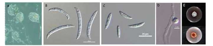 강낭콩 뿌리썩음병균 Fusarium phaseoli NC20745의 균학적 특성. A, sporodochia; B, macroconidia(scale bar =25μm); C, microconidia(scale bar =25μm); D, chlamydospore(scale bar =5μm); E, 14-day-old colony grown on PDA.