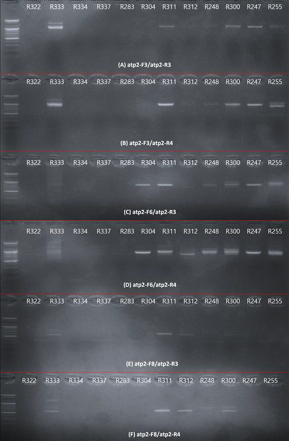 ATP2 유전자를 증폭하기 위한 primer 조합 테스트의 전기영동 결과사진