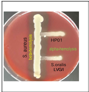 알파-용혈성을 보이는 균주 HP01과 표준균주 S. oralis LVG/I와 베타-용혈성을 보이는 황색포도상구균 Staphylococcus aureus을 교차접종한 혈액배지의 사진